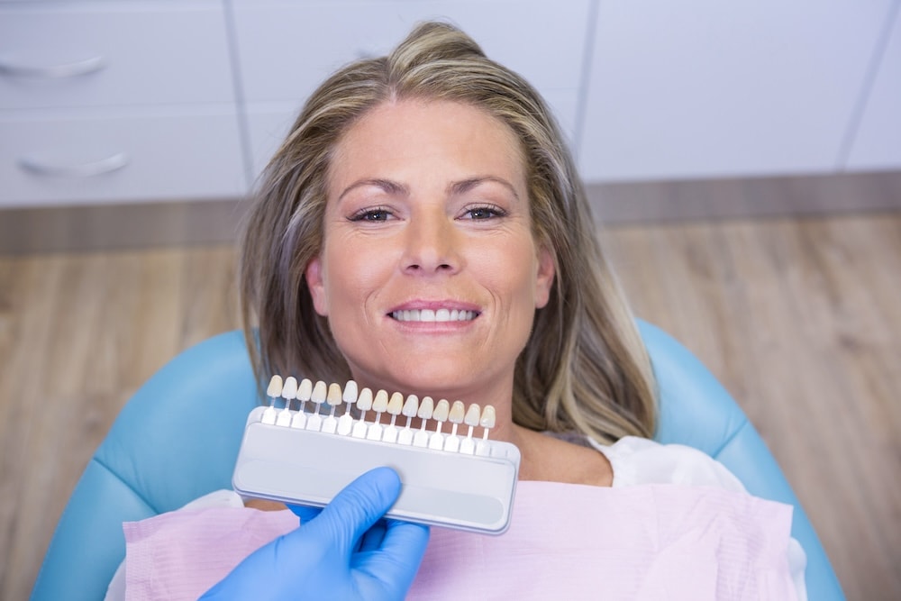 carillas-dentales-en-cullera