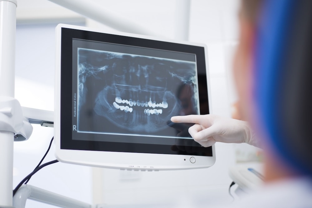 cirugia-dental-guiada-cullera